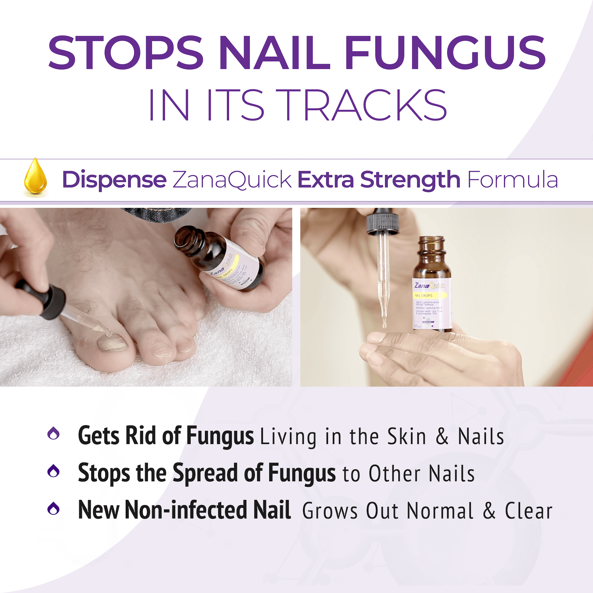 ZQ+ FUNGAL TOENAIL SOLUTION