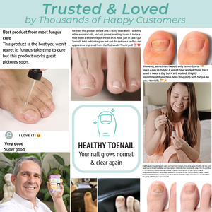 ZQ FUNGAL NAIL SOLUTION