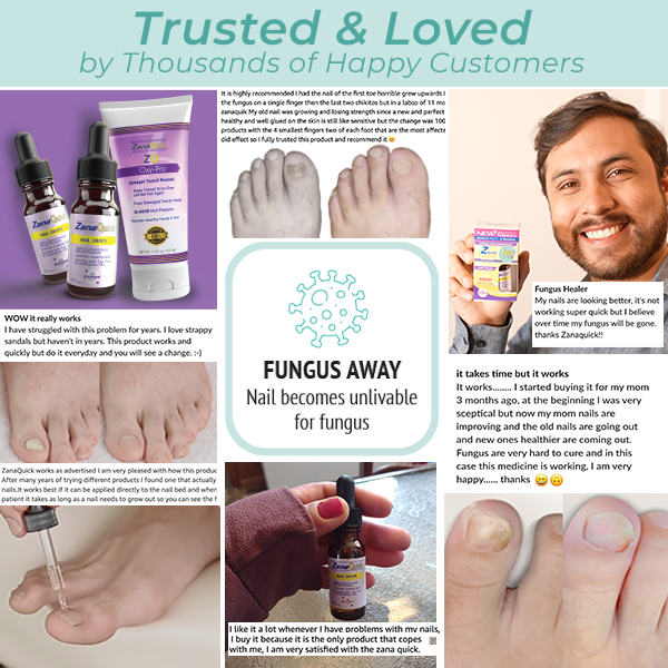 ZQ Fungal Toenail Solution